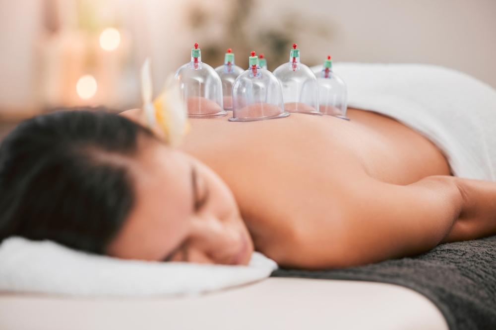 Cupping